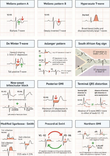 健康・医学 Occlusion image-6.png